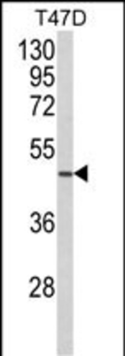 Invitrogen NCF1C Polyclonal Antibody 400 &mu;L | Buy Online | Invitrogen&trade; | Fisher Scientific