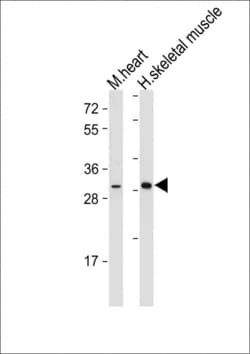 Invitrogen DIO2 Polyclonal Antibody 400 &mu;L; Unconjugated:Antibodies,