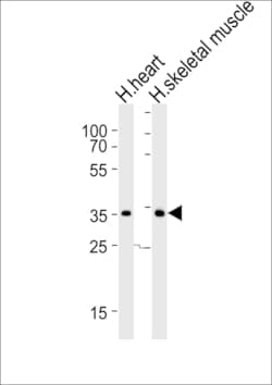 Invitrogen DIO2 Polyclonal Antibody 400 &mu;L; Unconjugated:Antibodies,