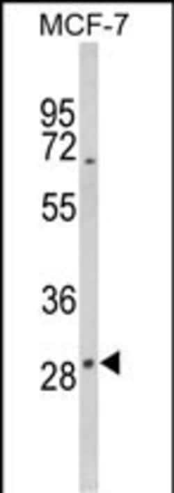 Invitrogen DIO2 Polyclonal Antibody 400 &mu;L; Unconjugated:Antibodies,
