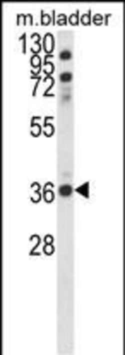 Invitrogen CCDC3 Polyclonal Antibody 400 &mu;L; Unconjugated:Antibodies,