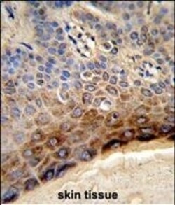 Invitrogen CTHRC1 Polyclonal Antibody 400 &mu;L | Buy Online | Invitrogen&trade; | Fisher Scientific