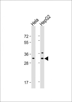 Invitrogen CTHRC1 Polyclonal Antibody 400 &mu;L | Buy Online | Invitrogen&trade; | Fisher Scientific