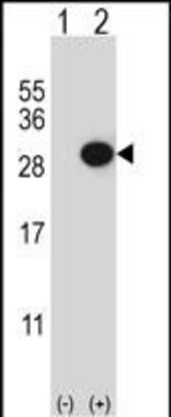 Invitrogen CTHRC1 Polyclonal Antibody 400 &mu;L | Buy Online | Invitrogen&trade; | Fisher Scientific
