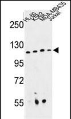 Invitrogen RPGRIP1 Polyclonal Antibody 400 &mu;L | Buy Online | Invitrogen&trade; | Fisher Scientific