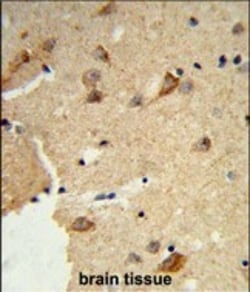 Invitrogen DTX4 Polyclonal Antibody 400 &mu;L; Unconjugated:Antibodies,