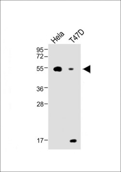 Invitrogen B4GALT1 Polyclonal Antibody 400 &mu;L; Unconjugated:Antibodies,