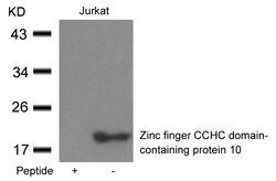Invitrogen ZCCHC10 Polyclonal Antibody 100 &mu;L; Unconjugated:Antibodies,