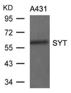 Invitrogen SS18 Polyclonal Antibody 100 &mu;L; Unconjugated:Antibodies,