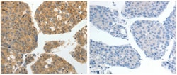 Invitrogen GRK4 Polyclonal Antibody 100 &mu;L; Unconjugated:Antibodies,