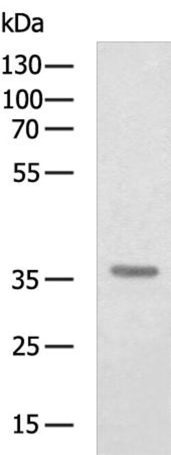 Invitrogen CFHR1 Polyclonal Antibody 100 &mu;L | Buy Online | Invitrogen&trade; | Fisher Scientific