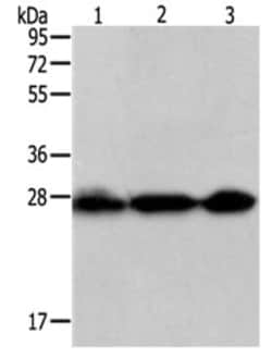 Invitrogen PDCD10 Polyclonal Antibody 100 &mu;L; Unconjugated:Antibodies,