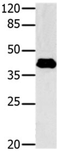 Invitrogen GNAZ Polyclonal Antibody 100 &mu;L | Buy Online | Invitrogen&trade; | Fisher Scientific