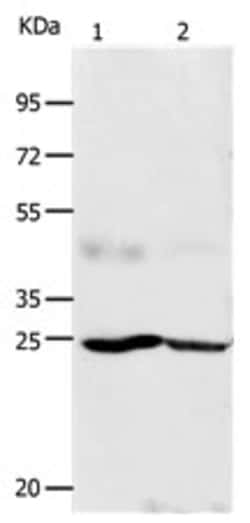Invitrogen KGF Polyclonal Antibody 100 &mu;L | Buy Online | Invitrogen&trade; | Fisher Scientific