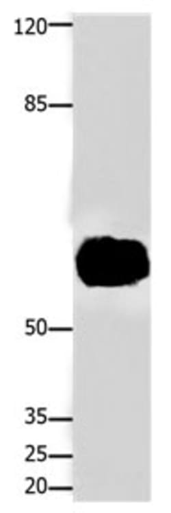 Invitrogen FOXJ3 Polyclonal Antibody 100 &mu;L | Buy Online | Invitrogen&trade; | Fisher Scientific