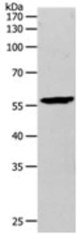 Invitrogen MMP27 Polyclonal Antibody 100 &mu;L | Buy Online | Invitrogen&trade; | Fisher Scientific