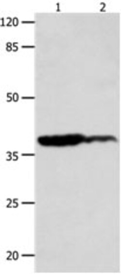 Invitrogen LPAR4 Polyclonal Antibody 100 &mu;L; Unconjugated:Antibodies,