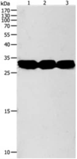 Invitrogen NIT2 Polyclonal Antibody 100 &mu;L | Buy Online | Invitrogen&trade; | Fisher Scientific