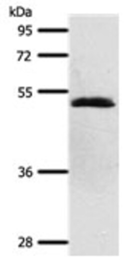 Invitrogen SCTR Polyclonal Antibody 100 &mu;L; Unconjugated:Antikörper