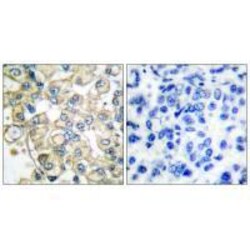 Invitrogen FGFR1OP Polyclonal Antibody 100 &mu;L | Buy Online | Invitrogen&trade; | Fisher Scientific