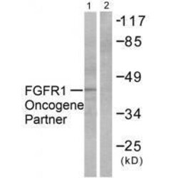 Invitrogen FGFR1OP Polyclonal Antibody 100 &mu;L | Buy Online | Invitrogen&trade; | Fisher Scientific