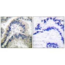 Invitrogen GUCY1B3 Polyclonal Antibody 100 &mu;L; Unconjugated:Antibodies,