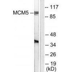 Invitrogen MCM5 Polyclonal Antibody 100 &mu;L | Buy Online | Invitrogen&trade; | Fisher Scientific