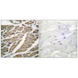 Invitrogen Sodium Channel Pan Polyclonal Antibody 100 &mu;L; Unconjugated:Antibodies,