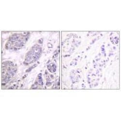 Invitrogen TGF beta-3 Polyclonal Antibody 100 &mu;L | Buy Online | Invitrogen&trade; | Fisher Scientific