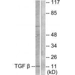 Invitrogen TGF beta-3 Polyclonal Antibody 100 &mu;L | Buy Online | Invitrogen&trade; | Fisher Scientific