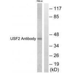 Invitrogen USF2 Polyclonal Antibody 100 &mu;L | Buy Online | Invitrogen&trade; | Fisher Scientific