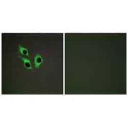 Invitrogen ANO9 Polyclonal Antibody 100 &mu;L; Unconjugated:Antibodies,