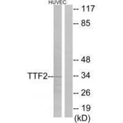 Invitrogen FOXE1 Polyclonal Antibody 100 &mu;L; Unconjugated:Antibodies,