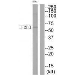 Invitrogen IGF2BP3 Polyclonal Antibody 100 &mu;L; Unconjugated:Antibodies,