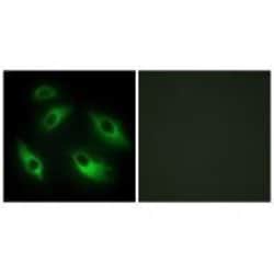 Invitrogen EphB6 Polyclonal Antibody 100 &mu;L; Unconjugated:Antibodies,