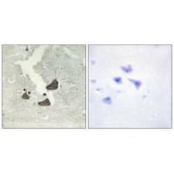 Invitrogen EphB6 Polyclonal Antibody 100 &mu;L; Unconjugated:Antibodies,