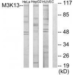 Invitrogen LZK Polyclonal Antibody 100 &mu;L; Unconjugated:Antibodies,