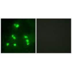 Invitrogen Hairless Polyclonal Antibody 100 μL; Unconjugated:Antibodies,