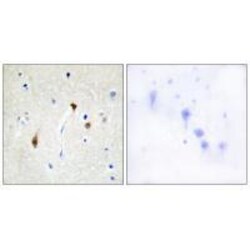 Invitrogen Hairless Polyclonal Antibody 100 μL; Unconjugated:Antibodies,