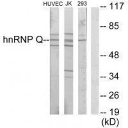 Invitrogen HnRNP Q Polyclonal Antibody 100 &mu;L | Buy Online | Invitrogen&trade; | Fisher Scientific