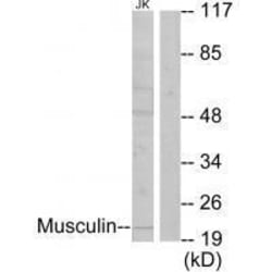 Invitrogen MSC Polyclonal Antibody 100 &mu;L; Unconjugated:Antibodies,