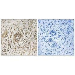 Invitrogen KIP2 Polyclonal Antibody 100 &mu;L; Unconjugated:Antibodies,