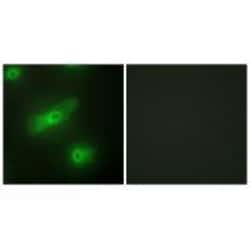 Invitrogen APRIL Polyclonal Antibody 100 &mu;L; Unconjugated:Antibodies,