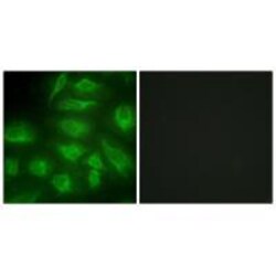 Invitrogen DGKI Polyclonal Antibody 100 &mu;L; Unconjugated:Antibodies,