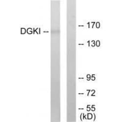 Invitrogen DGKI Polyclonal Antibody 100 &mu;L | Buy Online | Invitrogen&trade; | Fisher Scientific