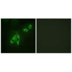 Invitrogen AKAP3 Polyclonal Antibody 100 &mu;L; Unconjugated:Antibodies,