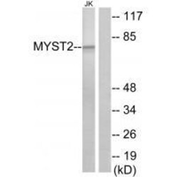 Invitrogen MYST2 Polyclonal Antibody 100 &mu;L; Unconjugated:Antibodies,