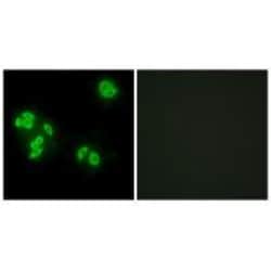 Invitrogen TNFAIP8 Polyclonal Antibody 100 &mu;L; Unconjugated:Antibodies,
