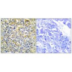 Invitrogen TNFAIP8 Polyclonal Antibody 100 &mu;L; Unconjugated:Antibodies,