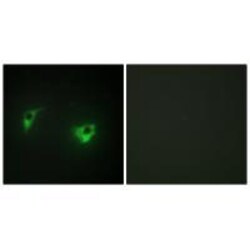 Invitrogen HGK Polyclonal Antibody 100 &mu;L | Buy Online | Invitrogen&trade; | Fisher Scientific